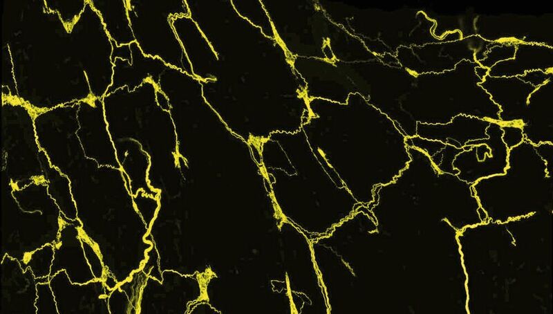 Die Axone der sensorischen Nervenzellen bilden ein feines Netzwerk in der Speiseröhre der Maus. Die Fortsätze der sensorischen Neuronen, die zu einem Nervenzellknoten des Vagusnervs (vagales Ganglion) gehören, sind mit einem fluoreszierenden Farbstoff angefärbt. Ein konfokales Mikroskop macht sie sichtbar.