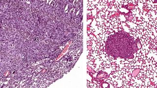 Links ein Lungentumor, der USP28 exprimiert. Rechts dagegen Tumore, in denen USP28 mittels Genschere „ausgeschnitten“ wurde – sie sind deutlich kleiner. (Bild: Markus Diefenbacher)