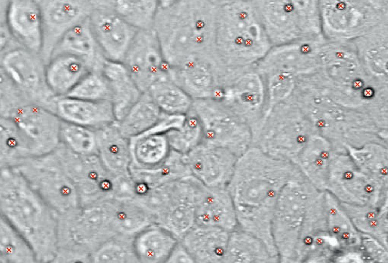 Abb.4: In diesem Beispiel wird die Verteilungsrate der Lipidtropfen pro Zelle  quantifiziert. (Archiv: Vogel Business Media)