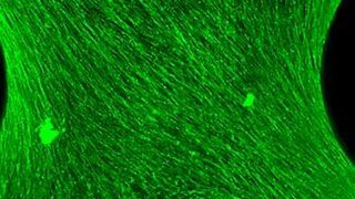 Das 3D-Bild zeigt faserige Zellen, die sich in einer bestimmten Richtung um die Kapillarbrücke drehen. (Max-Planck-Institut für Kolloid- und Grenzflächenforschung/Sebastian Ehrig)