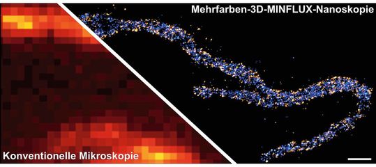 Zwei Proteine in der inneren Mitochondrienmembran sind angefärbt: Eine Untereinheit des MICOS-Komplexes leuchtet in orange, eine Untereinheit der ATP-Synthase leuchtet blau. Der Größenbalken entspricht 500 Nanometern. Zwei Proteine in der inneren Mitochondrienmembran sind angefärbt: Eine Untereinheit des MICOS-Komplexes leuchtet in orange, eine Untereinheit der ATP-Synthase leuchtet blau. Der Größenbalken entspricht 500 Nanometern.