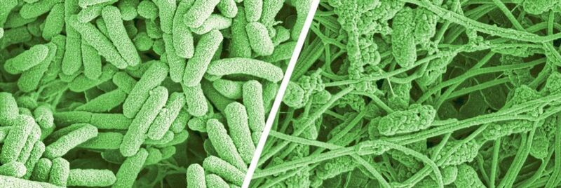 Vorher und nachher: Mikroskopieaufnahmen zeigen die Veränderungen an Pseudomonas-Wundkeimen. Normale Bakterien (l.) und behandelte Bakterien (r.) mit beginnendem Zerfall.