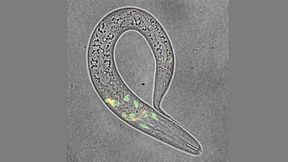 Mikroskopische Aufnahme des Fadenwurms C. elegans, dem Modellorganismus der TU-Dresden-Studie. (Bild: Byoungjun Park )