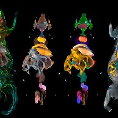 Whole-body 3D reconstruction
 (Source: Ali Ertürk Lab/ Helmholtz Munich)