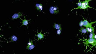 Myelin-Reparaturzellen (Oligodendrozyten) einer Maus in der Kulturschale. Sie stellen Myelin her (grün), das sie für die Reparatur der Nervenzell-Ummantelung verwenden. Zellkerne sind blau angefärbt. (Staroßom/Charité)