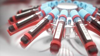 In Bio- und Life-Science-Laboren gehört die Zentrifuge zum Basisequipment (Symbolbild). (Bild: © ktsdesign - stock.adobe.com)