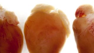 Titin: Defekte im größten Molekül des menschlichen Körpers können zu unterschiedlichen Herzleiden führen. (Ausschnitt) (© AG Michael Gotthardt / MDC )