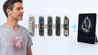 Ein Ultraschall-Wearable verbindet Schallwandler, Elektronik, Signalverarbeitung, Energieversorgung und Funk. Austauschbare Module sollen neue Anwendungen erleichtern. (Bild: Guido Deußing, KI-generiert, nach Kupsch et al. (2026).)
