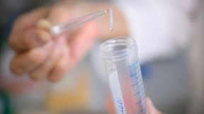 Bei der Genanalyse von 693.869 Menschen europäischer Abstimmung fand das Studienteam die bislang größte Anzahl genetischer Zusammenhänge mit Angstzuständen.  (Bild: © Daniel Peter / UKW)
