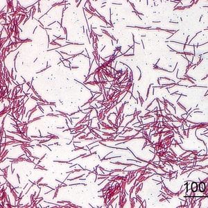 Lichtmikroskopische Aufnahme von Clostridium ramosum nach Gram-Färbung
