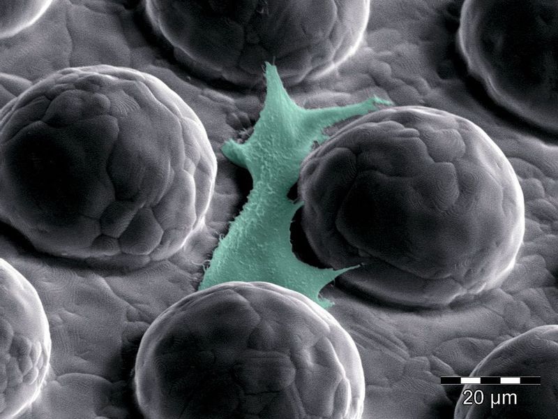 Bild 2: Rasterelektronenmikroskop-Aufnahme einer Edelstahl-Oberfläche mit einer Osteoblast-Zelle zwischen den Hemisphären. (Archiv: Vogel Business Media)