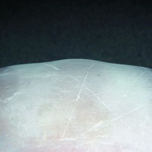 Bild 1: Ein typischer Schaden: Axiale Verschiebungen des Radbelages bei äußerlich unbeschädigten Rädern deuten auf eine Verflüssigung und Rekristallisation des Werkstoffs Vulkollan im Inneren des Radbelages hin.   Bild: Räder-Vogel