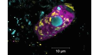 Der Endosymbiont Candidatus Azoamicus mariagerensis und sein Ciliatenwirt unter dem Fluoreszenzmikroskop. Zu sehen sind der Endosymbiont (gelb) und der Ciliat (violett). Der Zellkern des Ciliaten ist mit einem DNA-Farbstoff (blau) angefärbt. (Bild: MPI f. marine Mikrobiologie/ Linus Matz Zeller)