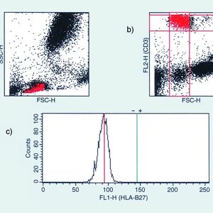 Abb. 1  Durchflusszytometrischer Nachweis des HLA-B27-Antigens auf T-Lymphozyten. a: Darstellung von Zellgranularität gegen Zellgröße der Leukozyten einer Blutprobe. Blutzelle und Zelltrümmer sind jeweils als Punkt dargestellt; b: Rote Fluoreszenzintensität gegen Leukozytenzellgröße derselben Blutprobe; c: Histogramm der grünen Fluoreszenzintensität auf den T-Lymphozyten.Ergebnis: HLA-B27-negative Blutprobe; Die T-Lymphozyten haben HLA-B27-Antikörper nicht spezifisch gebunden und fluoreszieren nur schwach. Median der Fluoreszenz FL1 = 95.