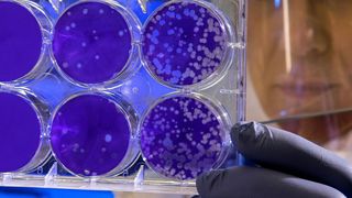 Due to antibiotic resistance, there’s a huge public health need to develop new antibiotics quickly. (Source: free licensed)