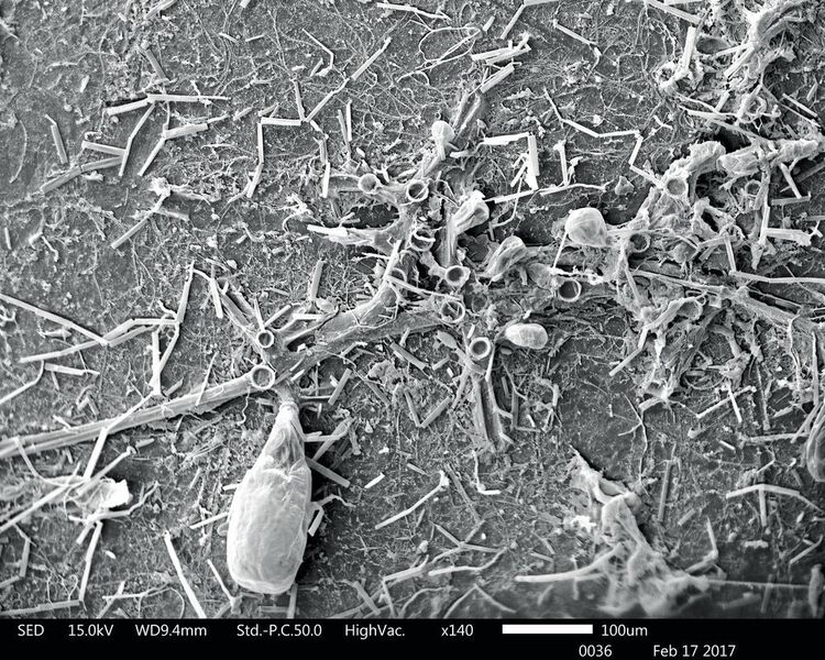 Abb.3: Mikroskopische Aufnahmen des mit Bakterien besiedelten Plastiks in 140facher Vergrößerung. (Maria Pinto)
