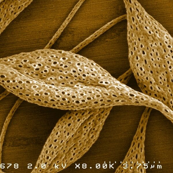 Nano fibres made from Poly lactic acid seen with an electron microscope. The porous formation and the characteristic thickenings are formed by the electrons' spin. (Picture: [M], Philipps-Universität Marburg)