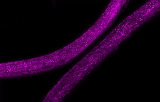 Maßgeschneiderte Lebende Materialien – Vom Labor in die Anwendung! Diese 3D-gedruckte Faser kapselt Bakterienkolonien, die ein violettes antimikrobielles Medikament produzieren, sicher ein.(Bild:  INM)