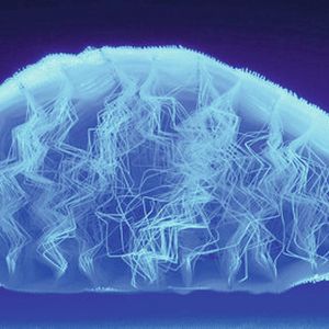 Einfach gekrümmte Abstandstruktur in Linensform, die außerdem auch federelastische Eigenschaften aufweist.