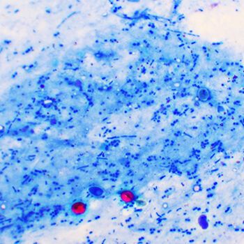 Cryptosporidium parvum lineages have exchanged more DNA in the last 200 years than in all the time before. Cryptosporidium parvum lineages have exchanged more DNA in the last 200 years than in all the time before.