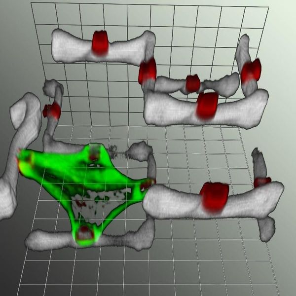 Abb. 2: Die Aufnahme der Zelle im Zweikomponenten-Polymergerüst entstand mithilfe eines Laser-Scanning-Mikroskops (LSM). Grün gefärbt ist das Zytoskelett der Zelle, weiß wiedergegeben werden Teile des Zweikomponenten-Polymergerüstes, die 