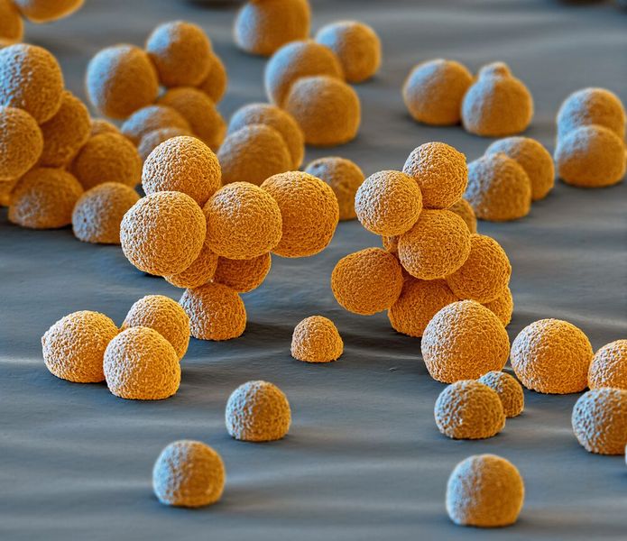 Kathodenmaterialien, deren Partikel möglichst gleich groß sind und eine regelmäßige Oberfläche haben, lassen sich in der Elektrode homogener und dichter packen. Das führt zu einer höheren Reichweite des Elektroautos (Mikroskopaufnahme mit Vergrößerung 1400:1).  (Bild: BASF)