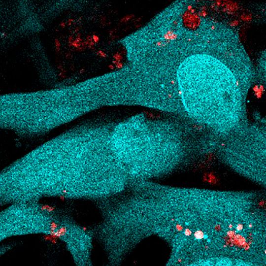 Brain vascular endothelial cells (blue) internalize particles released by erythrocytes infected with the malaria parasite (pink and red) Brain vascular endothelial cells (blue) internalize particles released by erythrocytes infected with the malaria parasite (pink and red)