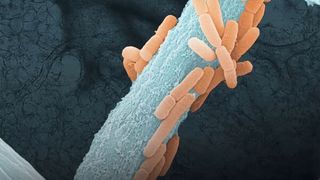 Das Wachstum von 𝘓𝘪𝘨𝘪𝘭𝘢𝘤𝘵𝘰𝘣𝘢𝘤𝘪𝘭𝘭𝘶𝘴 𝘮𝘶𝘳𝘪𝘯𝘶𝘴 (orange), Bestandteil des Lungenmikrobioms der Maus, entlang der Hyphen des lungenpathogenen Pilzes 𝘈𝘴𝘱𝘦𝘳𝘨𝘪𝘭𝘭𝘶𝘴 𝘧𝘶𝘮𝘪𝘨𝘢𝘵𝘶𝘴 (blau), mit Lungengewebe im Hintergrund.  (Bild: Liubov Nikitashina (Leibniz-HKI) und Sandor Nietzsche (EMZ-UKJ))