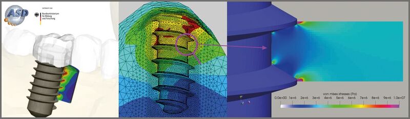 Das Bild zeigt ein Simulationsmodell zur Bewertung des Effekts von Oberflächenmodifikationen auf ein Dentalimplantat und den umgebenden Knochen. (Bild: ASD)