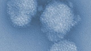 Influenza-Viren in elektronenmikroskopischer Vergrößerung (Bild: HZI / Rohde)