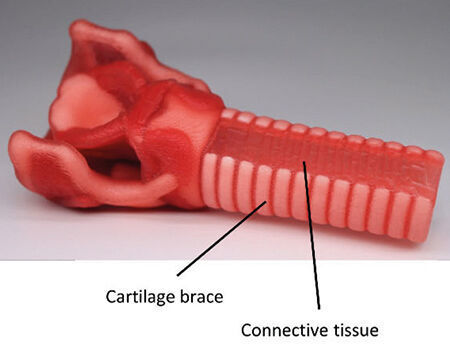 Das Intubationsmodell wurde mit einer neuartigen generischen Designmethode aus medizinischen CT-Bilddaten erstellt, die eine realistische Abbildung der Trachealkammer, des Kehlkopfes, der Muskeln, Bänder, Stimmbänder und Bindegewebe ermöglicht. Das Design ist für den Multimaterial-3D-Druck ausgelegt, wodurch komplexe anatomische Geometrien beibehalten werden können und das Bauteil aus mehreren verschiedenen Funktionskomponenten bestehen kann.
 (Anamos/ Purmundus Challenge)