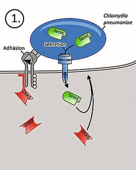 Ein Bakterium der Art Chlamydia pneumoniae bindet mithilfe von Adhäsinen (grau) von außen an Oberflächenproteine auf der menschlichen Zelle. Die Proteinnadel der Chlamydien durchdringt die Plasmamembran (PM) und transportiert das chlamydiale SemC-Protein (grün) aus dem Bakterieninneren direkt in die Humanzelle. (HHU / Dr. Sebastian Hänsch)