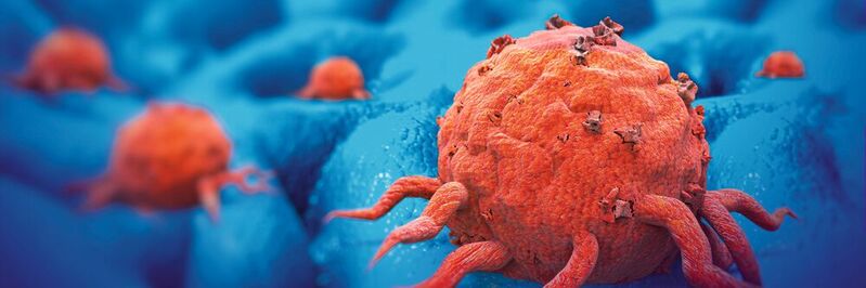 Krebstumore hemmen mitunter selbst die Entstehung von Metastasen – wie das passiert, haben Forscher nun aufgeklärt.