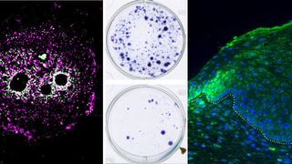 (v.l.n.r.): MYPOP-Lokalisation (magenta) in einer Hautzelle; Wachstum von HPV-Krebszellen ohne (oben) und mit MYPOP (unten); Gewebeschnitt eines HPV-Tumors (grün = MYPOP, blau = Zellkerne) (Universitätsmedizin Mainz)