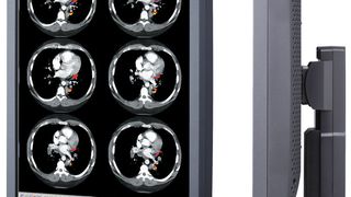 Der Monitor CCL214 von Totoku soll Röntgenbilder immer in der gleichen guten Qualität darstellen (JVCKenwood)