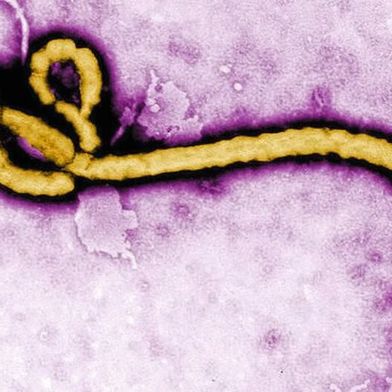 Kolorierte Transmissionselektronenmikroskopaufnahme eines Ebola-Viruspartikels. (Bild: CDC/Frederick A. Murphy)