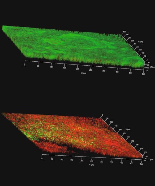 Bild 4: Aufnahmen mit einem konfokalen Laser-Scanning-Mikroskop eines fluoreszenzmarkierten, bakteriellen Biofilms nach einer Wachstumsphase von sieben Tagen.	 a Die Bakterien in dem Biofilm auf der Plasmapolymer-Beschichtung zeigen eine grüne Fluoreszenz und sind vital; b die Bakterien in dem Biofilm auf der Silber-Plasmapolymer-Beschichtung zeigen eine deutliche rote Fluoreszenz und sind tot.  (Bild: Bio-Gate)