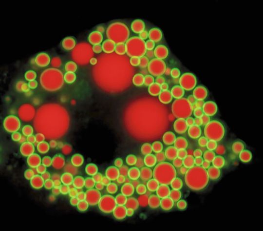 Fetttröpfchen in einer Zelle.(Bild:  (c) Johanna Spandl / Universität Bonn)