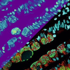 Die Metabolitenverteilungen als Heatmap (oberer linker Teil der Abbildung); Die untere rechte Seite des Bildes zeigt mikroskopische Details der Mikroben (in Rot und Grün) und der Muschelkerne (Cyan).