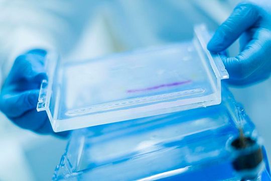 Die Gelelektrophorese ist ein zentrales Laborverfahren, um verschiedene Arten von Molekülen voneinander zu trennen (Symbolbild). Die Gelelektrophorese ist ein zentrales Laborverfahren, um verschiedene Arten von Molekülen voneinander zu trennen (Symbolbild).