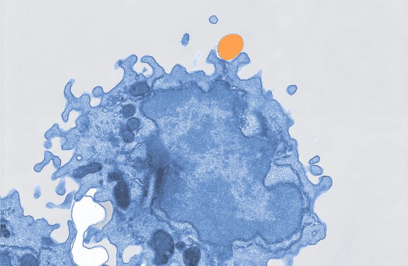 Immagine al microscopio elettronico con pseudocolorazione di un macrofago (blu) che ingloba microplastiche (arancione).(Bild:  Mass Lab/Università di Bonn)