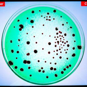 The display is clear and you can switch between the different modes easily via the touchscreen. The image file can also be saved after the count is complete.(Source:  Funke-Dr. N. Gerber Labortechnik)