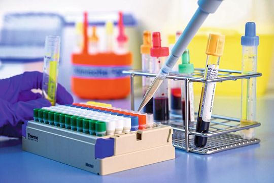In über 3.000 Blutproben suchen Forscher nach Biomarkern, die eine Diagnose und sogar Vorhersage von Alzheimer ermöglichen (Symbolbild). In über 3.000 Blutproben suchen Forscher nach Biomarkern, die eine Diagnose und sogar Vorhersage von Alzheimer ermöglichen (Symbolbild).