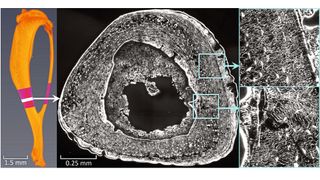 Mäuseknochen: Knochenschnitt unter Laser-Scanning-Mikroskop – vergrößerte Abbildung der dichten Netzwerkarchiktektur und des Flüssigkeitsstroms (Bild: Alexander van Tol / Max-Planck-Institut für Kolloid- und Grenzflächenforschung)