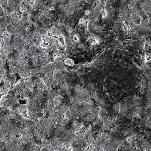 Infektion vorprogrammiert: Auf der Oberfläche eines Kalziumphosphatapatit, der nicht mit antimikrobiell wirksamen Substanzen modifiziert wurde, wachsen Staphylococcus-Bakterien.