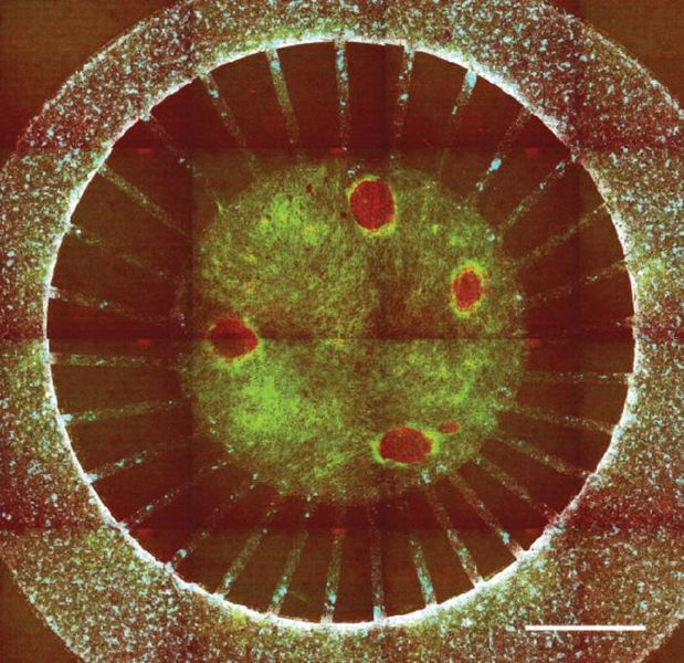 Ein nachgebildeter Tumor  Tumormodelle sollen Therapieerfolge vorhersagen und individuellere Behandlungen ermöglichen. Spanische Wissenschaftler haben nun das Miro-System entwickelt, mit dem Tumore und deren Umgebung mithilfe von Patientenzellen nachgebildet werden können.  Miro (Micro Immune Response On chip) dee trägt dazu bei, schneller neue Krebstherapien und personalisierte Behandlungen zu finden. Das System simuliert nicht nur den Tumor, sondern auch die Wechselwirkungen mit Immunzellen, was für den Erfolg von Immuntherapien entscheidend ist. Das repräsentative Bild oben zeigt eine Miro-Ko-Kultur am Tag 10, zusammengesetzt aus konfokalen Bildern, Zu sehen sind krebsassoziierte Fibroblasten (cancer-associated fibroblasts, CAFs; grün), Tumorspheroid (mit DAPI visualisiert, rot) und Immunzellen (cyan). Maßstab: 2 mm. Hier gehts zur Originalmeldung Wissenschaftsbild des Tages vom 13.2.2025   (Bild: Institute for Bioengineering of Catalonia (IBEC))