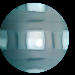 In ein 3D-Raster aus Polycaprolacton (PCL) werden Zellen des Patienten eingesetzt