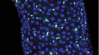 Sexualhormone steigern die Gefahr, dass onkogene Mutationen Tumoren auslösen. Das Bild zeigt Darmstammzellen mit einer krebstreibenden Mutation (grün) (Bild: Teleman/DKFZ)