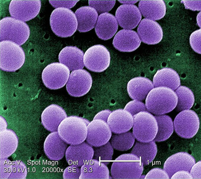 Multiresistente Bakterien wie Staphylococcus aureus stellen insbesondere in Krankenhäusern ein immer größeres medizinisches Problem dar.  (Bild: wikimedia)