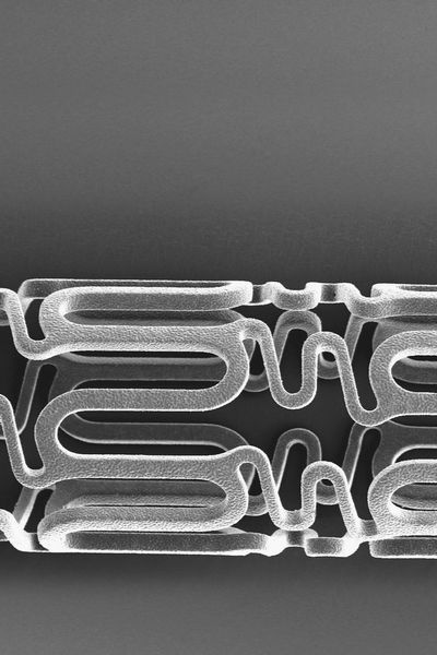 Wirkstoffbeschichtete Stents haben kardiovaskuläre Interventionen revolutioniert. Ohne innovative Oberflächentechnik wäre das nicht möglich gewesen. (Hemoteq)